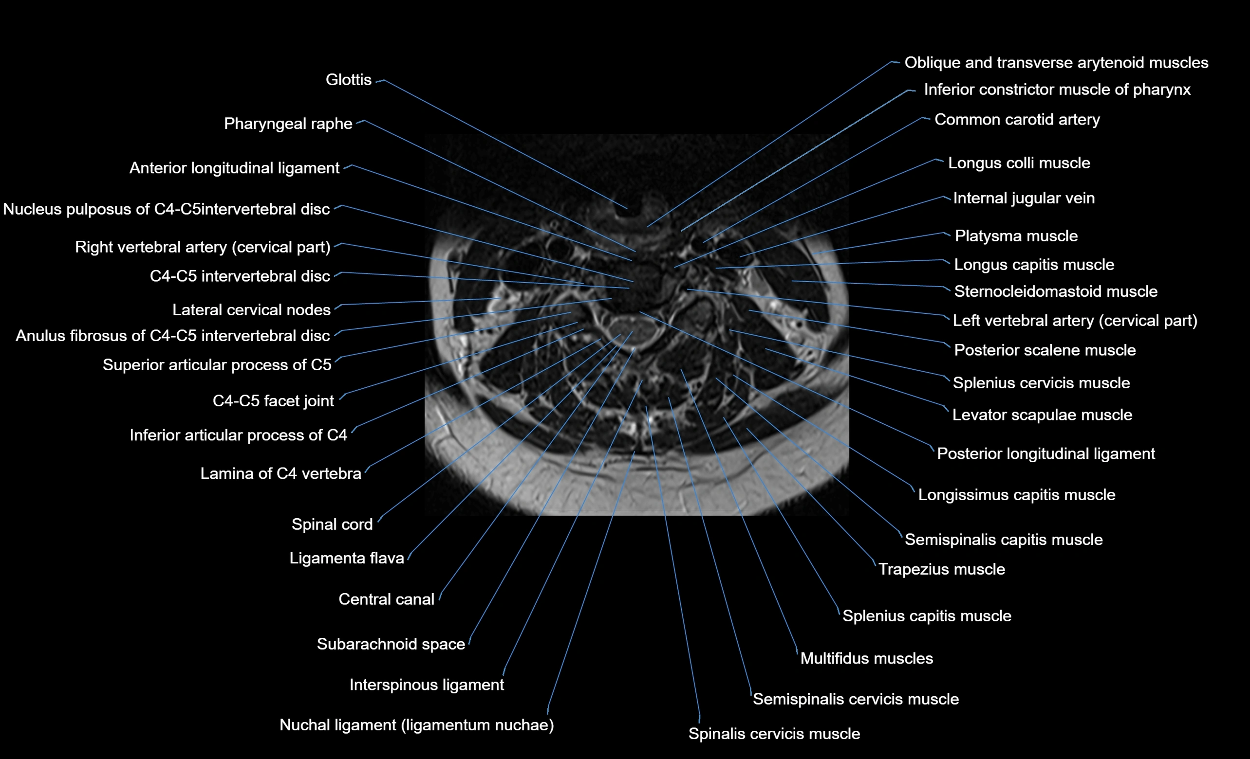 cervical spine cross sectional MRI anatomy  3T MRI axial  image-img-00001-00024.webp